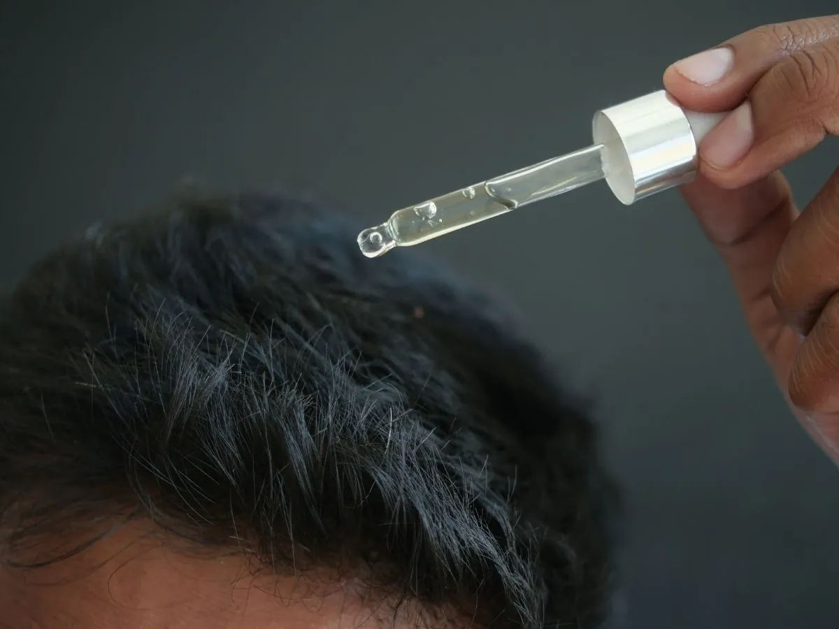 Comparing Minoxidil Foam vs Liquid: Which Is Better for Hair Regrowth? - andyou.ph